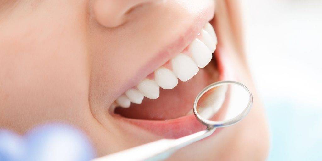 راهکارهای حفظ سفیدی دندان پس از بلچینگ دندان
