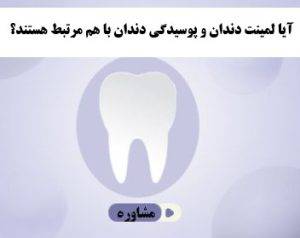 آیا لمینت دندان و پوسیدگی دندان با هم مرتبط هستند