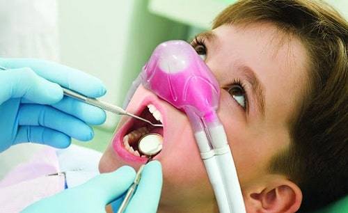 نیتروس اکساید در دندانپزشکی
