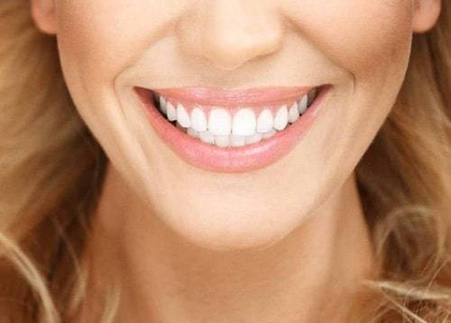 ارتباط لمینت دندان و پوسیدگی دندان